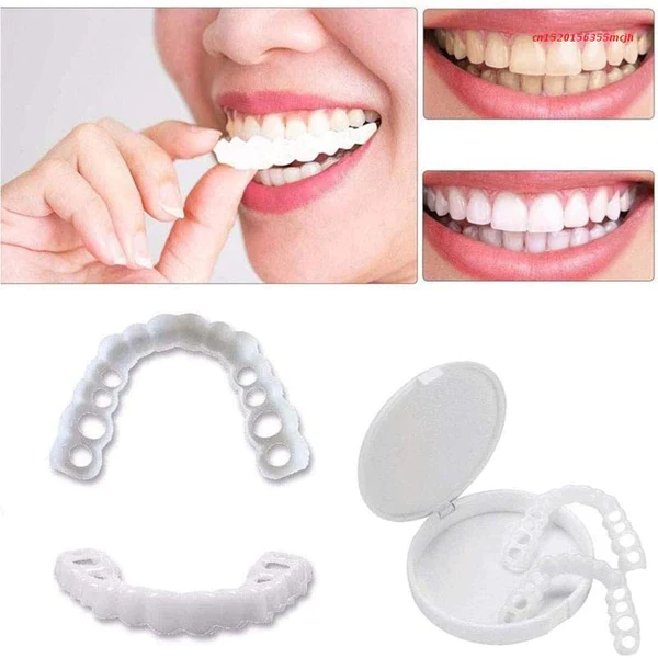 Dental White® Lens - Upper + Lower Kit (FULLY ADJUSTABLE TO ALL DENTAL ARCHES)
