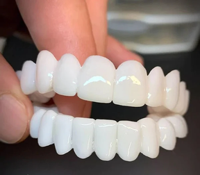 (PAY 1, GET 2) Dental White® Lens - Upper + Lower Kit (FULLY ADJUSTABLE TO ALL DENTAL ARCHES)
